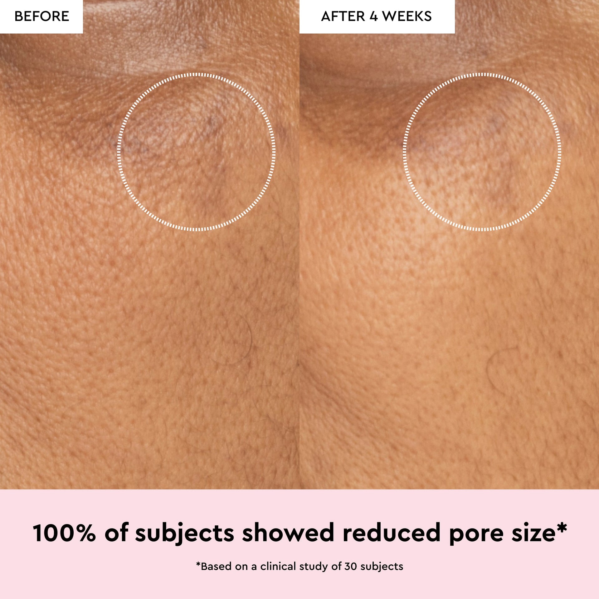 Watermelon Glow Niacinamide Dew Drops