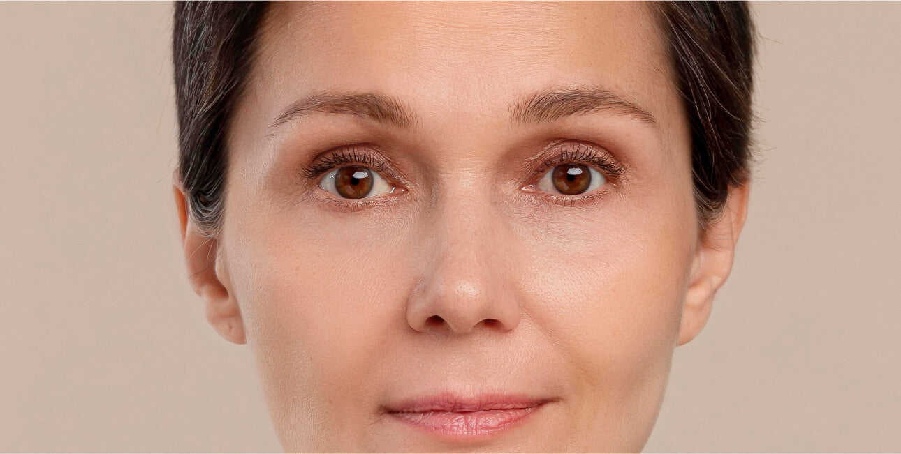 product-remedy-dark-spots-affter.jpg
