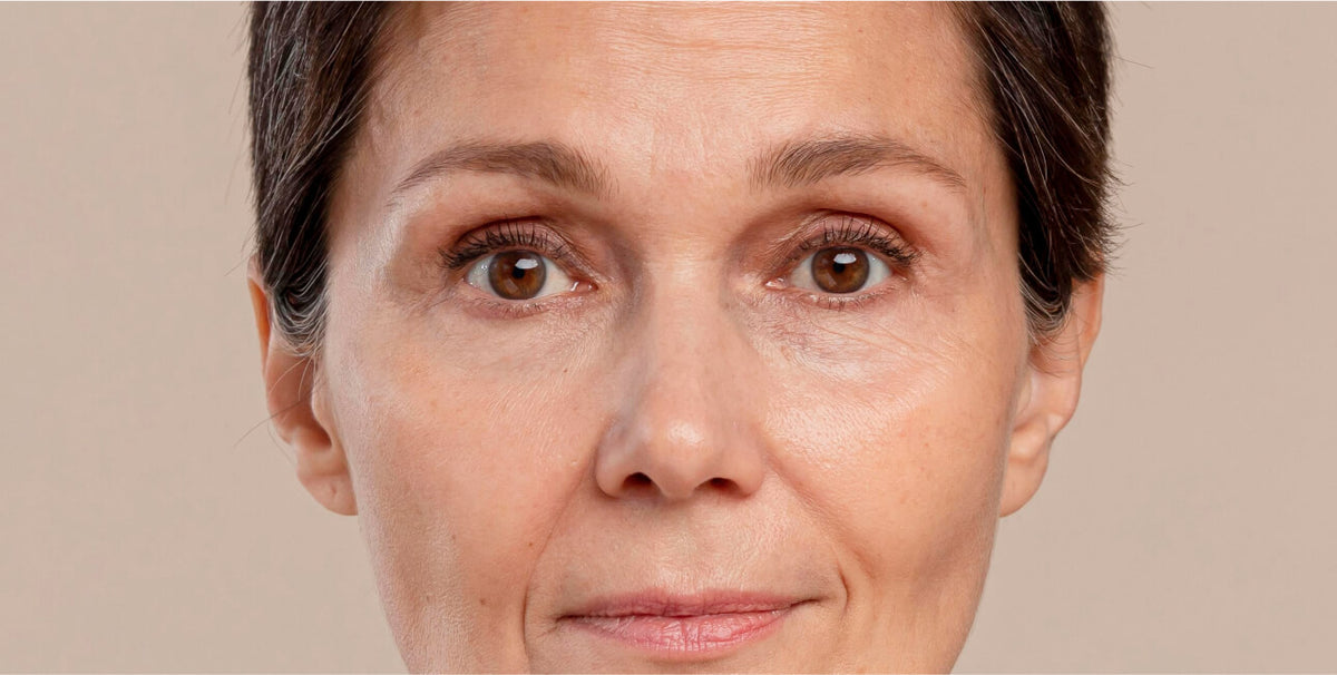 product-remedy-dark-spots-before.jpg