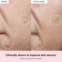 Watermelon Glow Niacinamide Dew Drops View 3