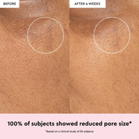Watermelon Glow Niacinamide Dew Drops View 4